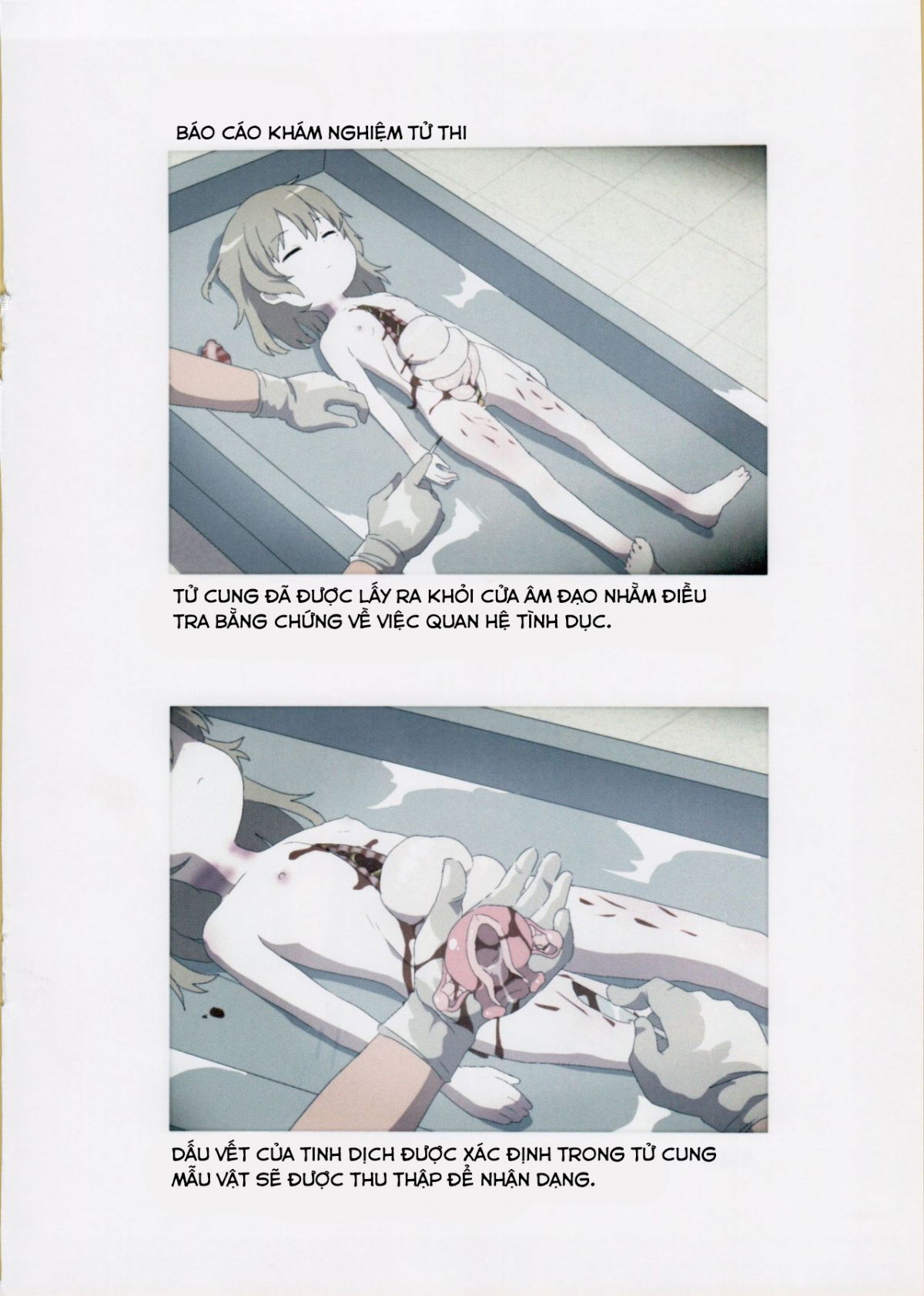 Đọc truyện hentai Hồ Sơ Báo Cáo Kết Quả Khám Nghiệm Tử Thi - Oneshot